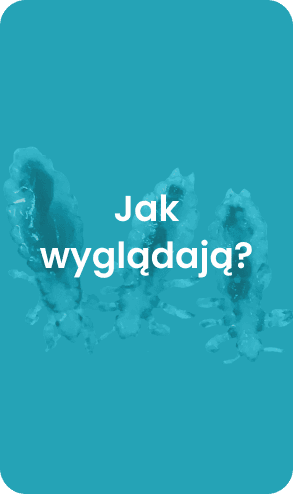Jak wyglądają?